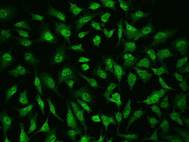 RBL1 / p107 Antibody - Immunofluorescence staining of RBL1 in Hela cells. Cells were fixed with 4% PFA, permeabilzed with 0.1% Triton X-100 in PBS, blocked with 10% serum, and incubated with rabbit anti-Human RBL1 polyclonal antibody (dilution ratio 1:200) at 4°C overnight. Then cells were stained with the Alexa Fluor 488-conjugated Goat Anti-rabbit IgG secondary antibody (green). Positive staining was localized to Nucleus and cytoplasm.