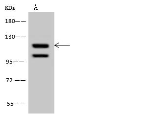 RBL1 / p107 Antibody - Anti-RBL1 rabbit polyclonal antibody at 1:500 dilution. Lane A: U-251 MG Whole Cell Lysate. Lysates/proteins at 30 ug per lane. Secondary: Goat Anti-Rabbit IgG (H+L)/HRP at 1/10000 dilution. Developed using the ECL technique. Performed under reducing conditions. Predicted band size: 121 kDa. Observed band size: 121 kDa.