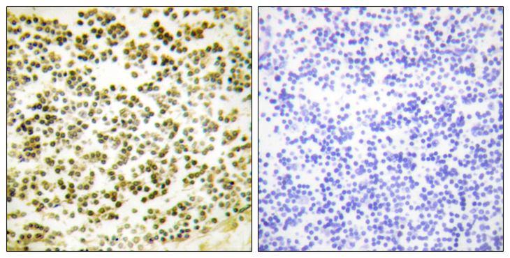 RBL1 / p107 Antibody - Immunohistochemistry analysis of paraffin-embedded human lymph node, using RBL1 (Phospho-Thr369) Antibody. The picture on the right is blocked with the phospho peptide.