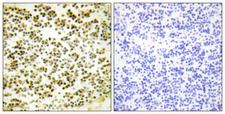 RBL1 / p107 Antibody - Immunohistochemistry analysis of paraffin-embedded human lymph node, using RBL1 (Phospho-Thr369) Antibody. The picture on the right is blocked with the phospho peptide.