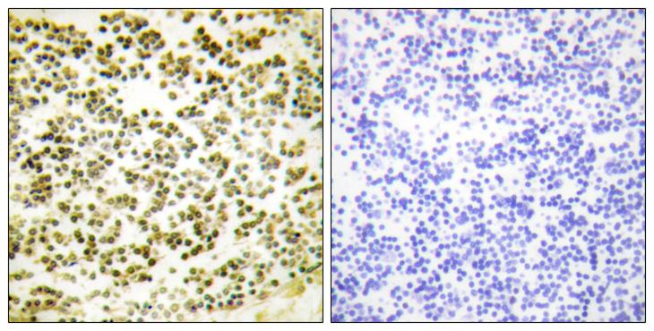 RBL1 / p107 Antibody - P-peptide - + Immunohistochemistry analysis of paraffin-embedded human lymph node tissue using RBL1 (Phospho-Thr369) antibody. RBL1 (Phospho-Thr369) antibody reacts with epitope-specific phosphopeptide and corresponding non-phosphopeptide.