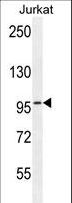 RBL2 / RB2 p130 Antibody - RBL2 Antibody western blot of Jurkat cell line lysates (35 ug/lane). The RBL2 antibody detected the RBL2 protein (arrow).