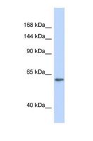 RBL2 / RB2 p130 Antibody - Western blot of Human HeLa. RBL2 antibody dilution 1.0 ug/ml.  This image was taken for the unconjugated form of this product. Other forms have not been tested.