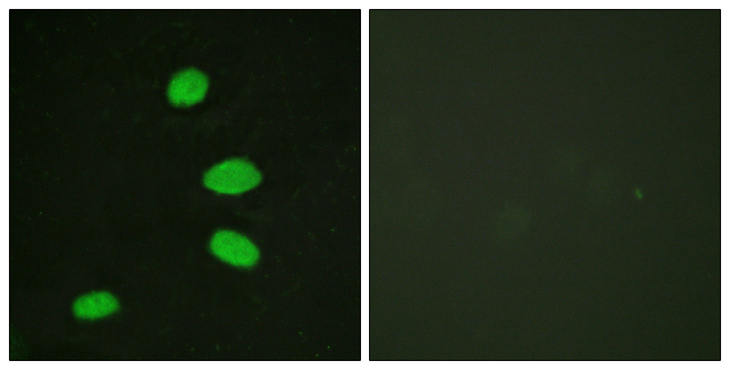 RBL2 / RB2 p130 Antibody - Immunofluorescence analysis of HeLa cells, using RBL2 Antibody. The picture on the right is blocked with the synthesized peptide.