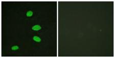RBL2 / RB2 p130 Antibody - Immunofluorescence analysis of HeLa cells, using RBL2 Antibody. The picture on the right is blocked with the synthesized peptide.