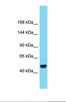 RBL2 / RB2 p130 Antibody - Western blot of Human Liver Tumor. RBL2 antibody dilution 1.0 ug/ml.  This image was taken for the unconjugated form of this product. Other forms have not been tested.