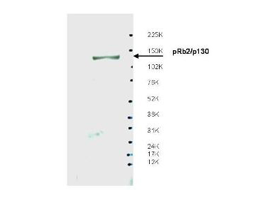 RBL2 / RB2 p130 Antibody - Anti-Spa310 Antibody - Western Blot. Western blot of affinity purified anti-Spa310 antibody shows detection of endogenous pRb2/p130 protein in whole LNCaP cell extracts. The band at ~130 kD, indicated by the arrowhead, corresponds to the expected molecular weight of pRb2/p130. The membrane was blocked overnight with a milk buffer at 4C. Primary antibody was diluted 1:500 and reacted with the membrane overnight at 4C. ECL was used for detection. Personal communication, Ang Sun, Sbarro Institute for Cancer Research and Molecular Medicine, Temple University, Philadelphia, PA.