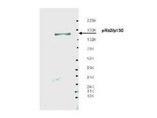 RBL2 / RB2 p130 Antibody - Western blot using the affinity purified anti-Spa310 antibody shows detection of endogenous pRb2/p130 protein in whole LNCaP cell extracts. The band at ~130 kDa, indicated by the arrowhead, corresponds to the expected molecular weight of pRb2/p130. The membrane was blocked overnight with a milk buffer at 4° C. Primary antibody was diluted 1:500 and reacted with the membrane overnight at 4° C. ECL was used for detection.