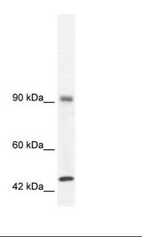 RBM10 Antibody - Daudi Cell Lysate.  This image was taken for the unconjugated form of this product. Other forms have not been tested.