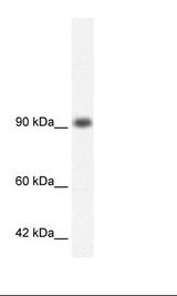 RBM10 Antibody - Daudi Cell Lysate.  This image was taken for the unconjugated form of this product. Other forms have not been tested.