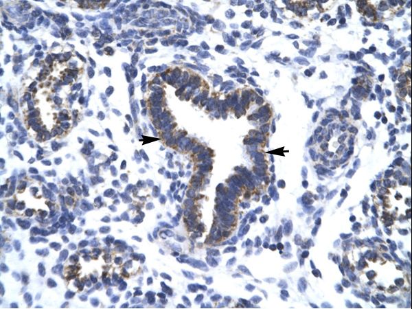 RBM10 Antibody - RBM10 antibody ARP30104_T100-NP_005667-RBM10 (RNA binding motif protein 10) Antibody was used in IHC to stain formalin-fixed, paraffin-embedded human lung.  This image was taken for the unconjugated form of this product. Other forms have not been tested.