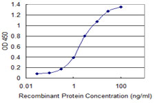 RBM10 Antibody - Detection limit for recombinant GST tagged RBM10 is 0.1 ng/ml as a capture antibody.