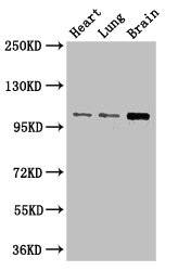 RBM10 Antibody - Western Blot Positive WB detected in: Mouse heart tissue, Mouse lung tissue, Mouse brain tissue All lanes: RBM10 antibody at 3µg/ml Secondary Goat polyclonal to rabbit IgG at 1/50000 dilution Predicted band size: 104, 95 kDa Observed band size: 104 kDa