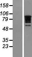 RBM10 Protein - Western validation with an anti-DDK antibody * L: Control HEK293 lysate R: Over-expression lysate