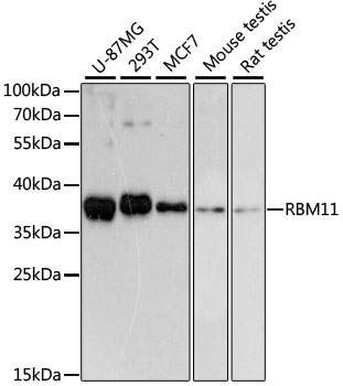 RBM11 Antibody - Western blot analysis of extracts of various cell lines, using RBM11 antibody at 1:3000 dilution. The secondary antibody used was an HRP Goat Anti-Rabbit IgG (H+L) at 1:10000 dilution. Lysates were loaded 25ug per lane and 3% nonfat dry milk in TBST was used for blocking. An ECL Kit was used for detection and the exposure time was 90s.