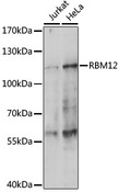 RBM12 Antibody - Western blot analysis of extracts of various cell lines, using RBM12 antibody at 1:1000 dilution. The secondary antibody used was an HRP Goat Anti-Rabbit IgG (H+L) at 1:10000 dilution. Lysates were loaded 25ug per lane and 3% nonfat dry milk in TBST was used for blocking. An ECL Kit was used for detection and the exposure time was 180s.