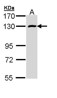 RBM15 Antibody - Sample (30 ug of whole cell lysate). A: A431 . 7.5% SDS PAGE. OTT / RBM15 antibody diluted at 1:1000.