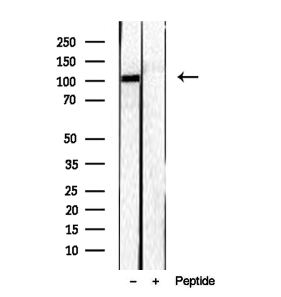 RBM15 Antibody - Western blot analysis of extracts of HEK293 cells using RBM15 antibody.