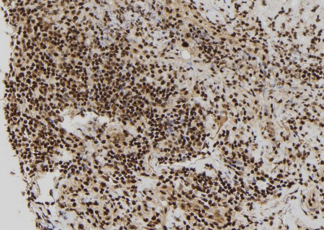 RBM15 Antibody - 1:100 staining human spleen tissue by IHC-P. The sample was formaldehyde fixed and a heat mediated antigen retrieval step in citrate buffer was performed. The sample was then blocked and incubated with the antibody for 1.5 hours at 22°C. An HRP conjugated goat anti-rabbit antibody was used as the secondary.