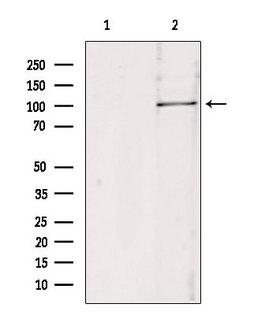 RBM15 Antibody - Western blot analysis of extracts of 293 cells using RBM15 antibody. Lane 1 was treated with the blocking peptide.