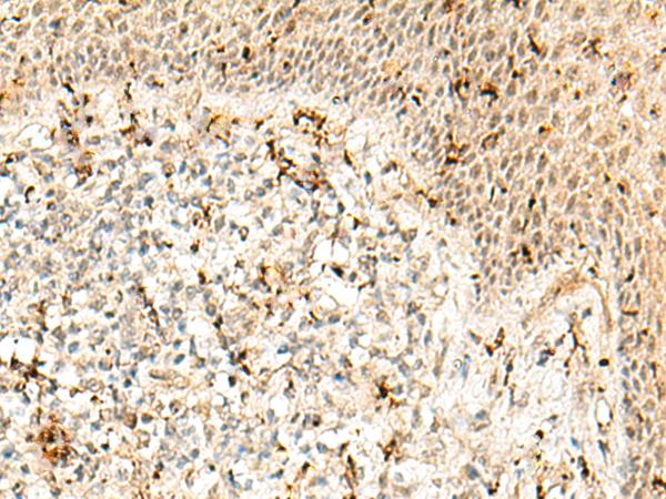 RBM15 Antibody - Immunohistochemistry of paraffin-embedded Human tonsil tissue  using RBM15 Polyclonal Antibody at dilution of 1:50(×200)