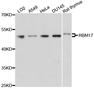 RBM17 Antibody - Western blot analysis of extracts of various cell lines.