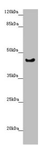 RBM17 Antibody - Western blot All lanes: RBM17 antibody at 2.35µg/ml + U251 whole cell lysate Secondary Goat polyclonal to rabbit IgG at 1/10000 dilution Predicted band size: 45 kDa Observed band size: 45 kDa