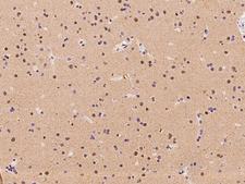 RBM17 Antibody - Immunochemical staining of human RBM17 in human brain with rabbit polyclonal antibody at 1:100 dilution, formalin-fixed paraffin embedded sections.