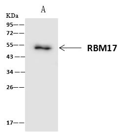 RBM17 Antibody - RBM17 was immunoprecipitated using: Lane A: 0.5 mg Raji Whole Cell Lysate. 4 uL anti-RBM17 rabbit polyclonal antibody and 60 ug of Immunomagnetic beads Protein A/G. Primary antibody: Anti-RBM17 rabbit polyclonal antibody, at 1:100 dilution. Secondary antibody: Clean-Blot IP Detection Reagent (HRP) at 1:1000 dilution. Developed using the ECL technique. Performed under reducing conditions. Predicted band size: 45 kDa. Observed band size: 45 kDa.
