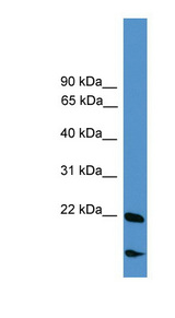 RBM18 Antibody - RBM18 antibody Western blot of COLO205 cell lysate. This image was taken for the unconjugated form of this product. Other forms have not been tested.