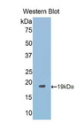 RBM20 Antibody - Western blot of recombinant RBM20.  This image was taken for the unconjugated form of this product. Other forms have not been tested.