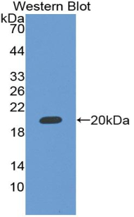 RBM20 Antibody - Western Blot; Sample: Recombinant protein.