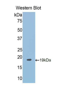 RBM20 Antibody - Western blot of recombinant RBM20.  This image was taken for the unconjugated form of this product. Other forms have not been tested.