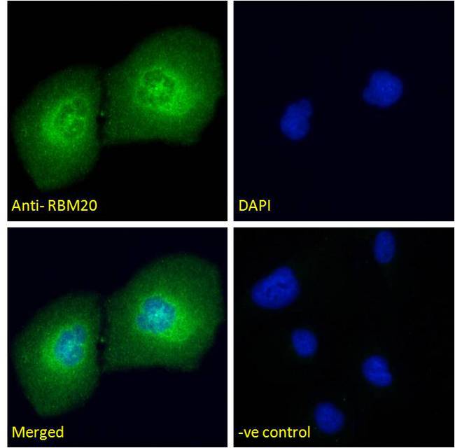RBM20 Antibody - RBM20 antibody immunofluorescence analysis of paraformaldehyde fixed U2OS cells, permeabilized with 0.15% Triton. Primary incubation 1hr (10ug/ml) followed by Alexa Fluor 488 secondary antibody (4ug/ml), showing njuclear and Golgi apparatus staining. The nuclear stain is DAPI (blue). Negative control: Unimmunized goat IgG (10ug/ml) followed by Alexa Fluor 488 secondary antibody (4ug/ml).