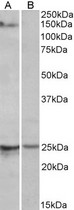 RBM20 Antibody - RBM20 antibody (1µg/ml) staining of Mouse Heart lysate (35µg protein in RIPA buffer) with (B) and without (A) blocking with the immunising peptide. Detected by chemiluminescence.