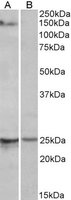 RBM20 Antibody - RBM20 antibody (1 ug/ml) staining of Mouse Heart lysate (35 ug protein/ml in RIPA buffer) with (B) and without (A) blocking with the immunizing peptide. Primary incubation was 1 hour. Detected by chemiluminescence.