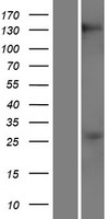 RBM20 Protein - Western validation with an anti-DDK antibody * L: Control HEK293 lysate R: Over-expression lysate