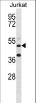 RBM22 Antibody - RBM22 Antibody western blot of Jurkat cell line lysates (35 ug/lane). The RBM22 antibody detected the RBM22 protein (arrow).