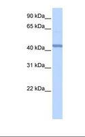 RBM22 Antibody - Hela cell lysate. Antibody concentration: 1.0 ug/ml. Gel concentration: 12%.  This image was taken for the unconjugated form of this product. Other forms have not been tested.