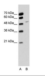 RBM22 Antibody - A: Marker, B: Jurkat Cell Lysate.  This image was taken for the unconjugated form of this product. Other forms have not been tested.