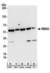 RBM22 Antibody - Detection of Human and Mouse RBM22 by Western Blot. Samples: Whole cell lysate from 293T (15 and 50 ug), HeLa (50 ug), Jurkat (50 ug), and mouse NIH3T3 (50 ug) cells. Antibodies: Affinity purified rabbit anti-RBM22 antibody used for WB at 0.1 ug/ml. Detection: Chemiluminescence with an exposure time of 30 seconds.
