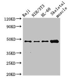 RBM22 Antibody - Western Blot Positive WB detected in: Raji whole cell lysate, NIH/3T3 whole cell lysate, HL60 whole cell lysate, Mouse skeletal muscle tissue All lanes: RBM22 antibody at 2.7µg/ml Secondary Goat polyclonal to rabbit IgG at 1/50000 dilution Predicted band size: 47, 42 kDa Observed band size: 47 kDa