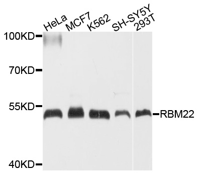 RBM22 Antibody - Western blot analysis of extracts of various cell lines, using RBM22 antibody at 1:1000 dilution. The secondary antibody used was an HRP Goat Anti-Rabbit IgG (H+L) at 1:10000 dilution. Lysates were loaded 25ug per lane and 3% nonfat dry milk in TBST was used for blocking. An ECL Kit was used for detection and the exposure time was 30s.