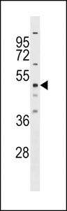 RBM23 Antibody - RBM23 Antibody western blot of HeLa cell line lysates (35 ug/lane). The RBM23 antibody detected the RBM23 protein (arrow).