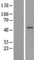 RBM23 Protein - Western validation with an anti-DDK antibody * L: Control HEK293 lysate R: Over-expression lysate