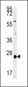 RBM24 Antibody - RBM24 Antibody western blot of mouse heart tissue lysates (15 ug/lane). The RBM24 antibody detected RBM24 protein (arrow).