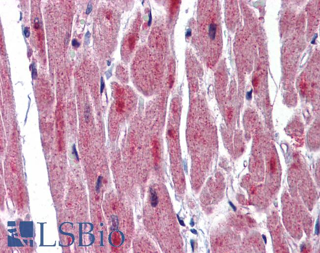 RBM24 Antibody - Anti-RBM24 antibody IHC of human heart. Immunohistochemistry of formalin-fixed, paraffin-embedded tissue after heat-induced antigen retrieval. Antibody concentration 5 ug/ml.  This image was taken for the unconjugated form of this product. Other forms have not been tested.