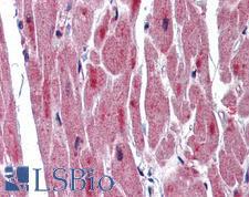 RBM24 Antibody - Anti-RBM24 antibody IHC of human heart. Immunohistochemistry of formalin-fixed, paraffin-embedded tissue after heat-induced antigen retrieval. Antibody concentration 5 ug/ml.  This image was taken for the unconjugated form of this product. Other forms have not been tested.