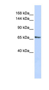 RBM26 / SE70 Antibody - RBM26 antibody Western blot of HepG2 cell lysate. This image was taken for the unconjugated form of this product. Other forms have not been tested.