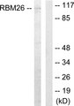RBM26 / SE70 Antibody - Western blot analysis of lysates from Jurkat cells, using RBM26 Antibody. The lane on the right is blocked with the synthesized peptide.